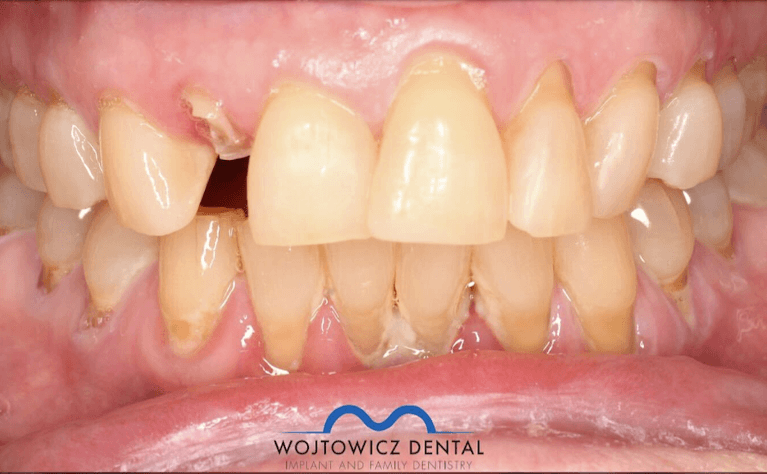 Dental-Emergency-Before-Image