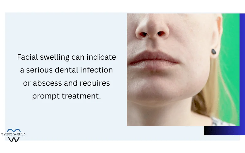 Facial Swelling and Swollen Gums
