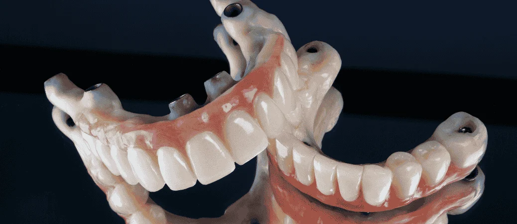 Finding a More Secure Fit Without Over Treating