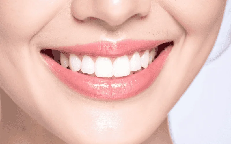 Protecting Your Smile How to Keep Your Natural Teeth