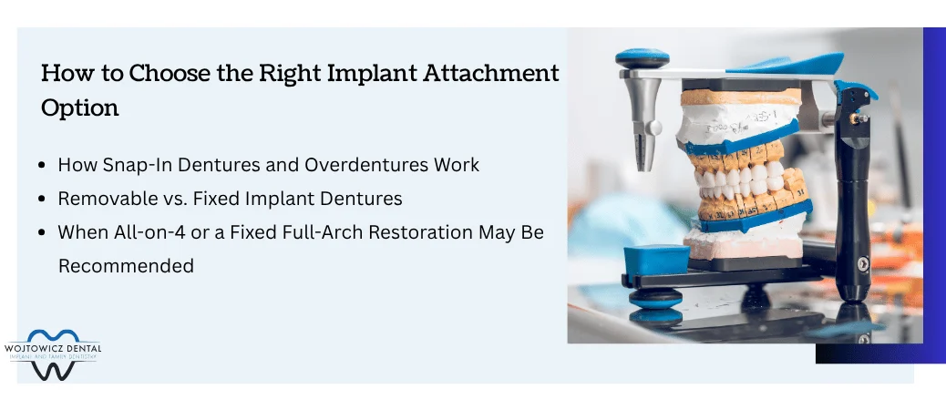 Which Implant Attachment Option Fits Your Routine